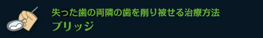 失った歯の両隣の歯を削り被せる治療方法