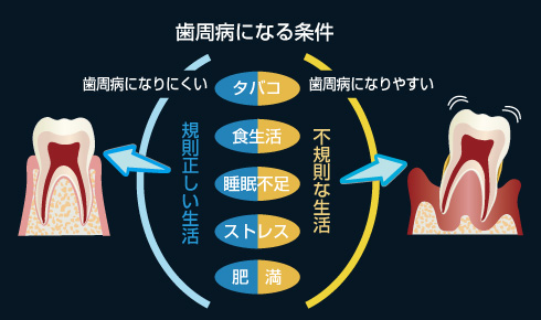 歯周病になる条件