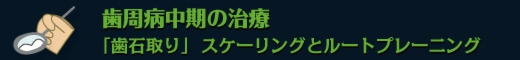 歯周病中期の治療　「歯石取り」  スケーリングとルートプレーニング