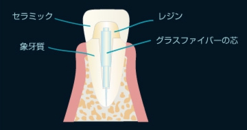 ファイバーコア