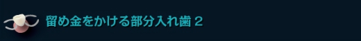 留め金をかける部分入れ歯2