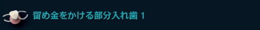 留め金をかける部分入れ歯1