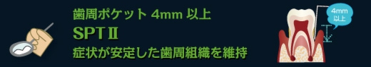 歯周ポケット4mm以上　SPTⅡ　症状が安定した歯周組織を維持