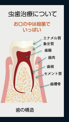 虫歯治療について