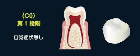 (C0)第1段階