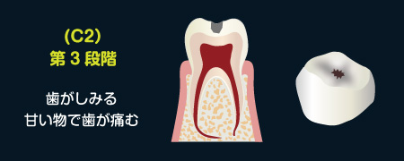 (C2)第3段階